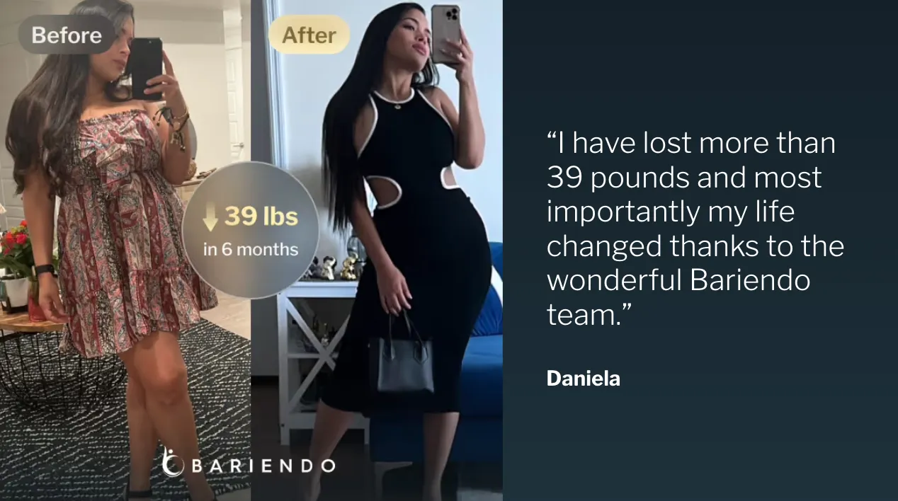 Before and after photos of gastric balloon patient Daniela who lost 39 lbs