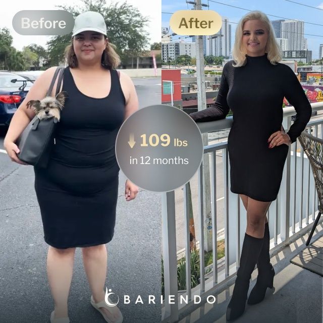 Before and after images of Nicole, a Bariendo ESG Stomach Tightening® patient who lose 109 pounds in 12 months