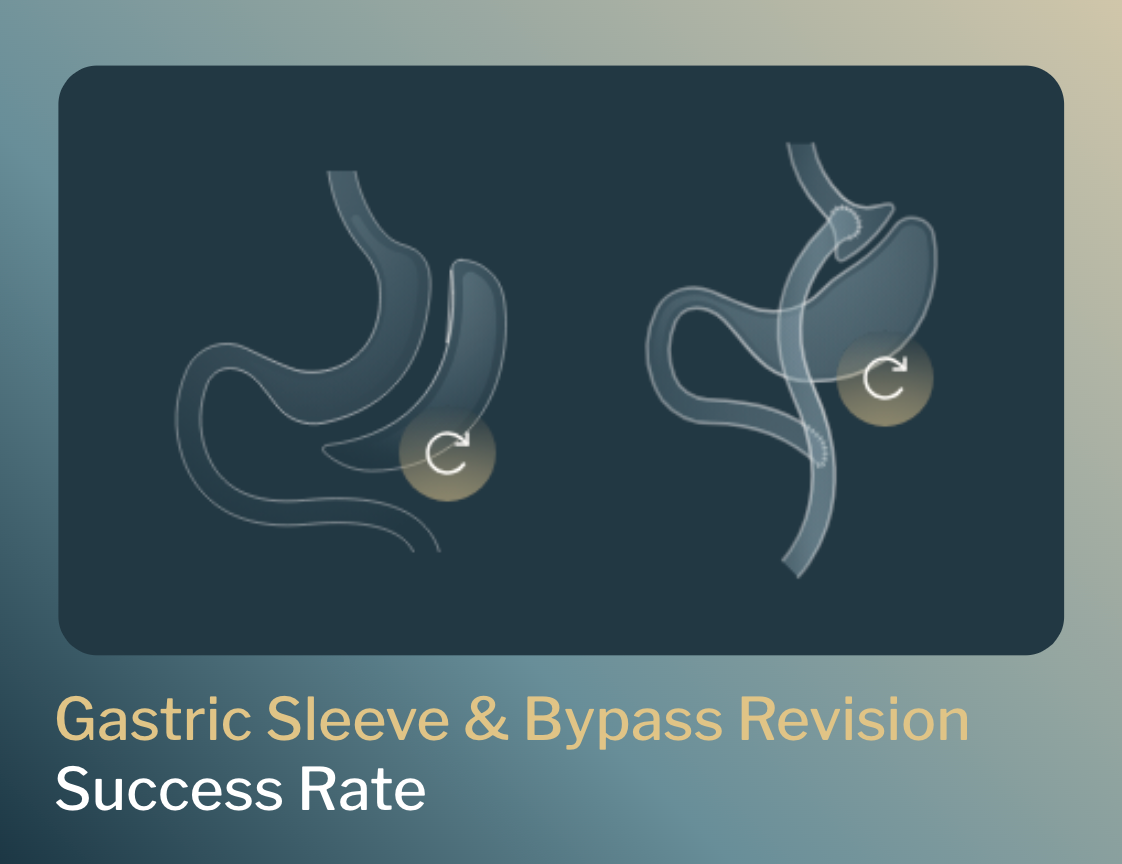 Gastric sleeve revision & gastric bypass revision