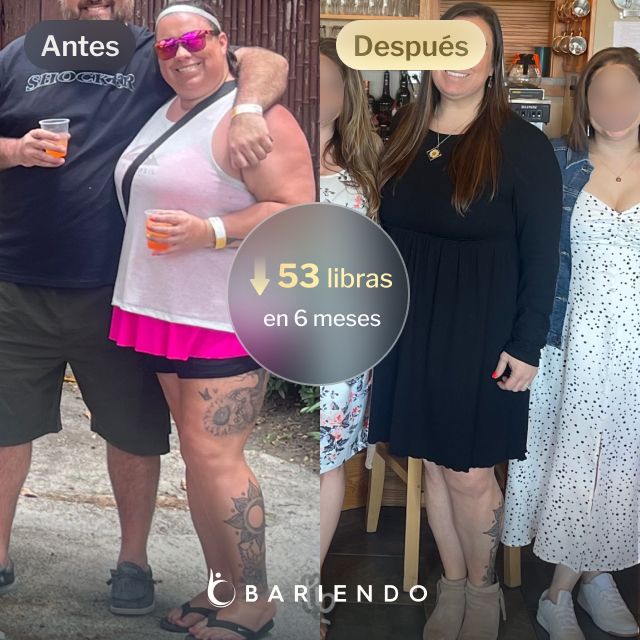 Imágenes de antes y después de Mindi, la paciente ESG de Bariendo que perdió 43 libras en 6 meses