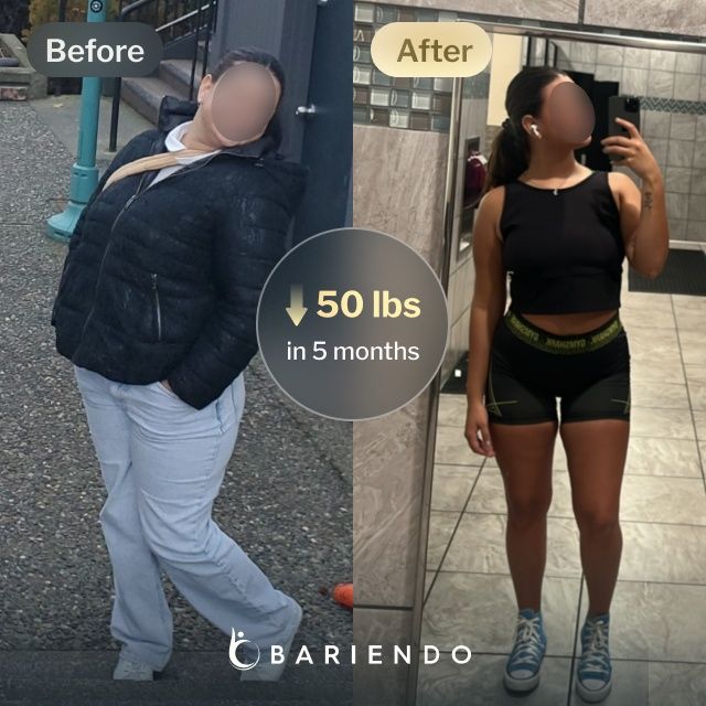 Before and after images of Margarett , a Bariendo Gastric Balloon patient who lose 50 pounds in 5 months