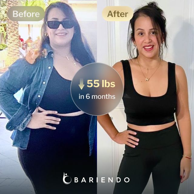 Before and after images of Anais who lost 55 pounds in 6 months after a Gastric Balloon procedure with Bariendo