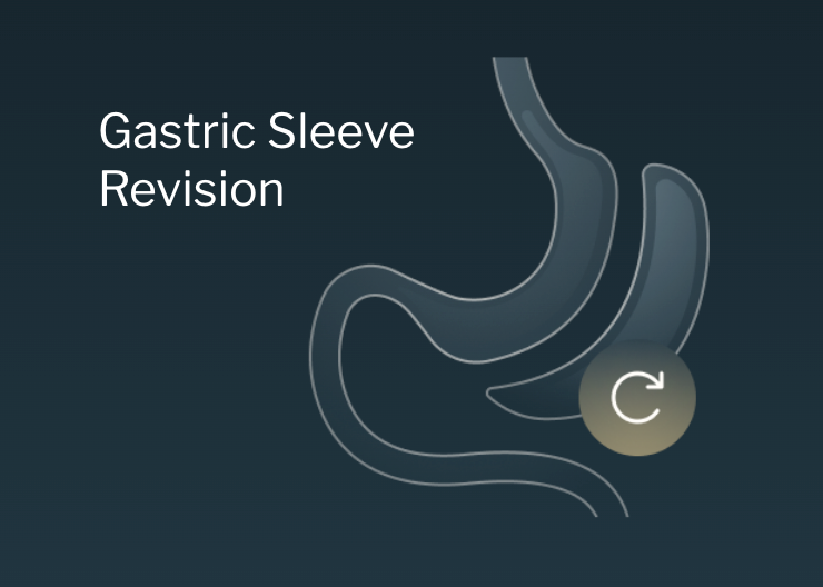 Gastric sleeve revision or re-sleeving