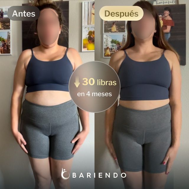 Imágenes de antes y después de Iris, quien perdió 30 libras en 4 meses después de un procedimiento de Balón Gástrico con Bariendo