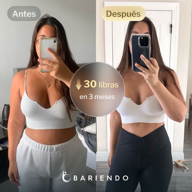 Imágenes de antes y después de Patricia, una paciente de Reducción de Estómago ESG de Bariendo que perdió 30 libras en 3 meses