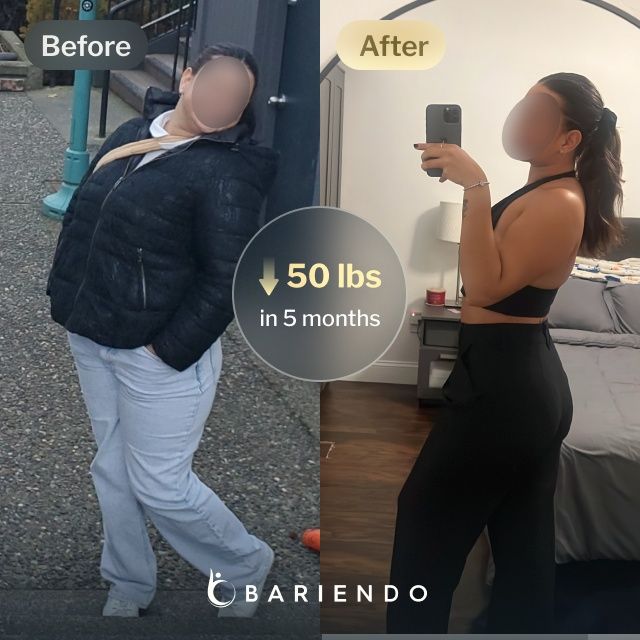 Before and after images of Margarett , a Bariendo Gastric Balloon patient who lose 50 pounds in 5 months