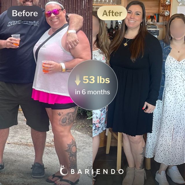 Before and after images of Mindi who lost 53 pounds in 6 months through Bariendo's non-surgical revision procedure