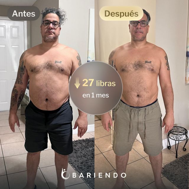 Imágenes de antes y después de César, quien perdió 49 libras en 5 meses gracias al procedimiento de Reducción de Estómago ESG de Bariendo
