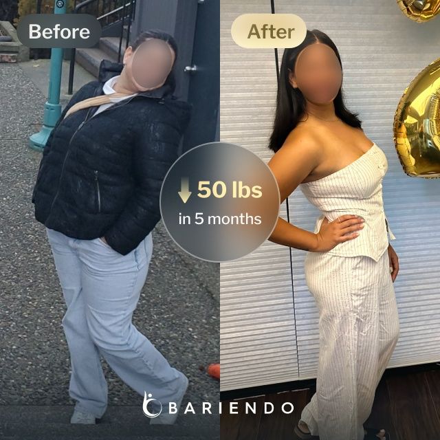 Before and after images of Margarett , a Bariendo Gastric Balloon patient who lose 50 pounds in 5 months