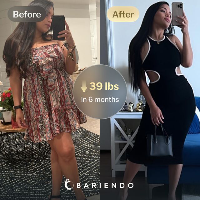 Before and after images of Daniela who lost 39 pounds in 6 months after a Gastric Balloon procedure with Bariendo