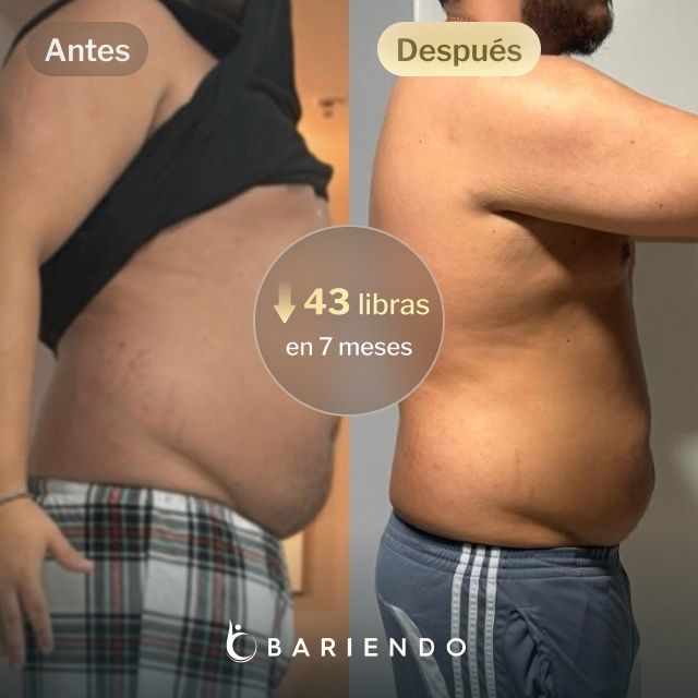 Imágenes de antes y después de Juan, quien perdió 43 libras en 7 meses después de un procedimiento de Balón Gástrico con Bariendo