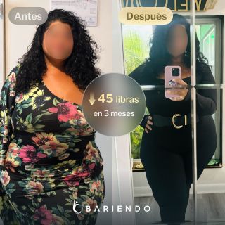 Imágenes de antes y después de Erin, quien perdió 45 libras en 3 meses después de una revisión de gastrectomía en manga - SIS con Bariendo