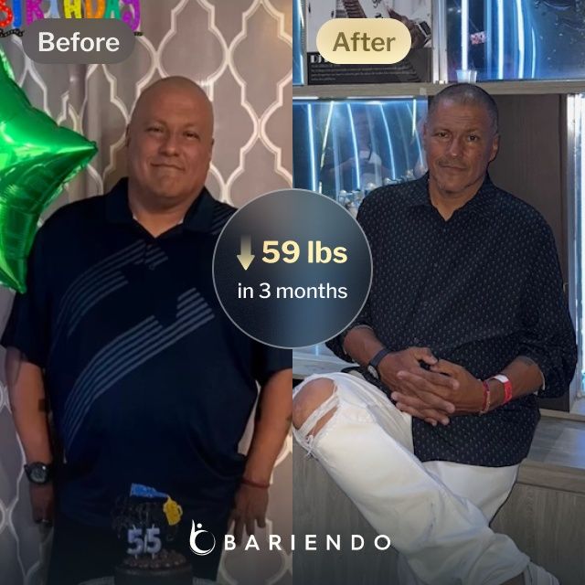 Before and after images of Hernando who lost 59 pounds in 3 months after a ESG procedure with Bariendo