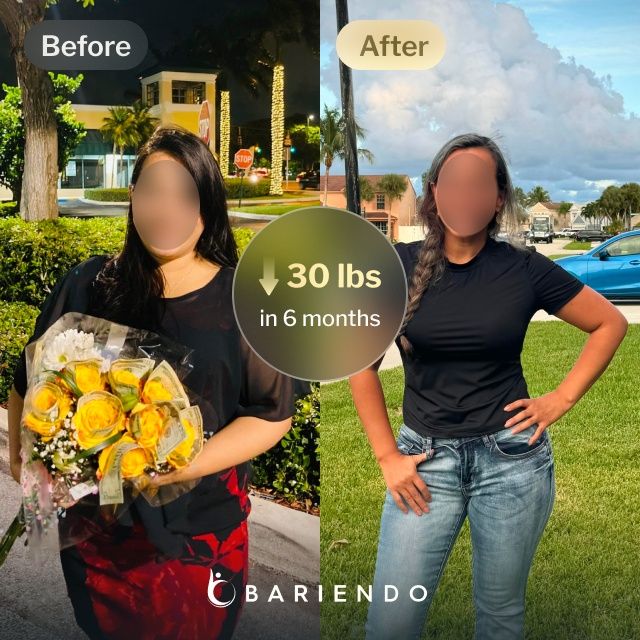 Before and after images of Diana who lost 30 pounds in 6 month through Bariendo's ESG Stomach Tightening® procedure