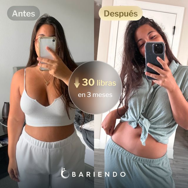 Imágenes de antes y después de Patricia, una paciente de Reducción de Estómago ESG de Bariendo que perdió 30 libras en 3 meses
