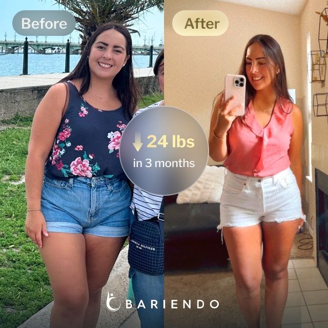 Before and after images of Angelica who lost 24 pounds in 3 months after a ESG procedure with Bariendo