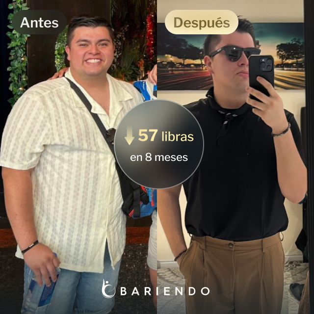 Imágenes de antes y después de Javier que perdió 57 libras en 8 meses después de un procedimiento ESG