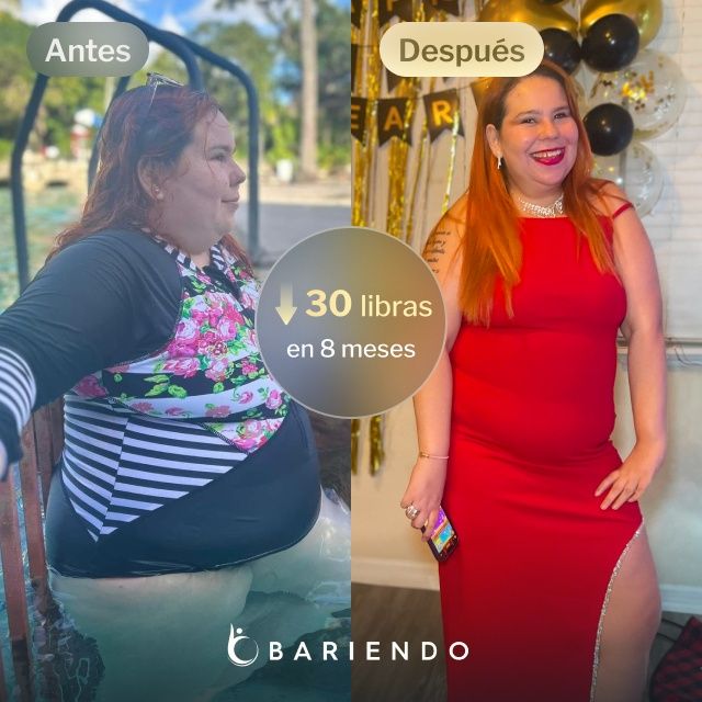 Imágenes de antes y después de Isola, quien perdió 30 libras en 8 meses tras un procedimiento de Balón Gástrico con Bariendo