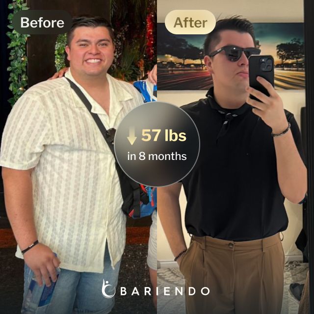 Before and after images of Javier who lost 57 pounds in 8 months after an ESG procedure