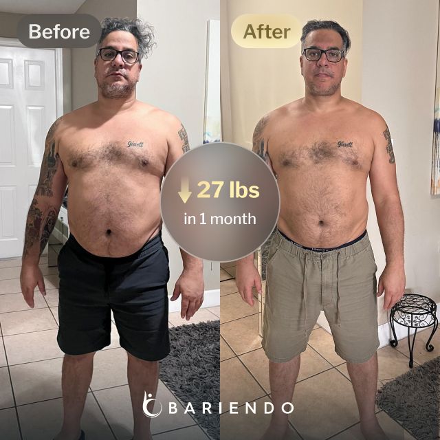 Before and after images of Cesar who lost 27 pounds in 1 month through Bariendo's ESG Stomach Tightening™ procedure