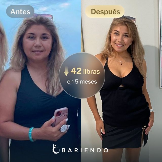 Imágenes de antes y después de Amelia, quien perdió 42 libras en 5 meses después de un procedimiento ESG con Bariendo