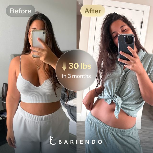 Before and after images of Patricia, a Bariendo ESG Stomach Tightening™ patient who lost 30 pounds in 3 months