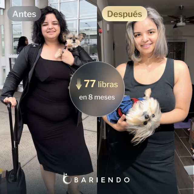 Imágenes de antes y después de Nicole, una paciente de Bariendo ESG que se endurece el estómago y que pierde 77 libras en 7 meses