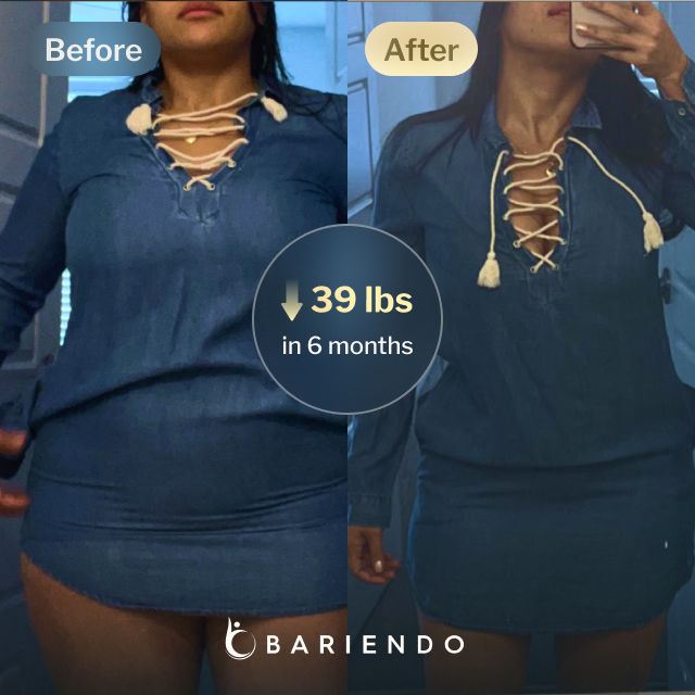 Before and after images of Daniela who lost 39 pounds in 6 months after a Gastric Balloon procedure with Bariendo