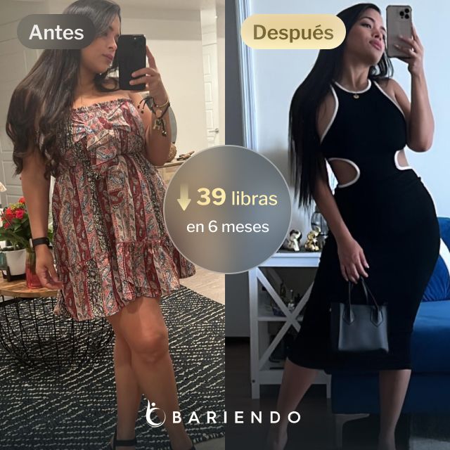 Imágenes de antes y después de Daniela, quien perdió 39 libras en 6 meses tras un balón gástrico con Bariendo.